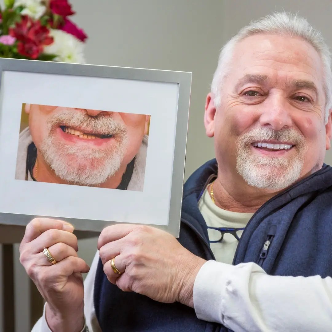 proud-man-showing-dental-results