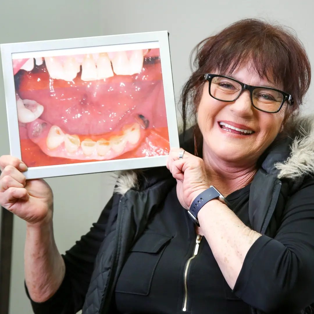 proud-woman-showing-dental-results